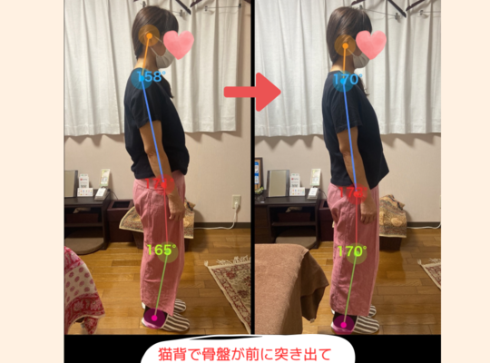 姿勢調整