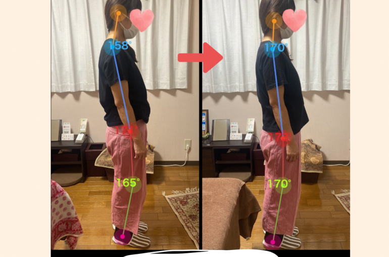 姿勢調整